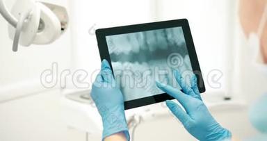 牙科医生检查平板电脑X射线扫描